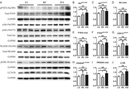 Figure 2. Metabolism genes in LV, RV and IVS in mice (n=6). Note: GLUT1, versusglucose transporter 1; GLUT4, glucose transporter 4; PPARα, peroxisome proliferator-activated receptor α; PPARγ, peroxisome proliferator-activated receptor γ; PPARδ, peroxisome proliferator-activated receptor δ; PGC-1α, peroxisome proliferator-activated receptor gamma coactivator 1α; PDK4, Pyruvate dehydrogenase lipoamide kinase isozyme 4; *P<0.05, **P<0.01,  LV.
