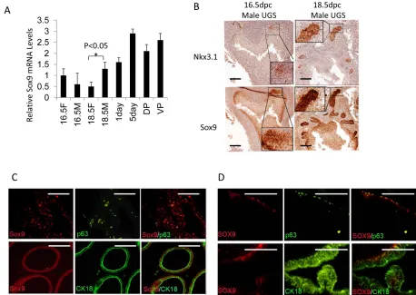 Figure 1: Sox9 and Nkx3.1 expression in UGS and adult prostate. A. Sox9 mRNA levels in male (M) and female (F) UGS at different ages (16.5F or 16.5M =16.5-dpc female or male UGS, 18.5F or 18.5M =18.5-dpc female or male UGS, 1day or 5day=1 or 5 day prostate