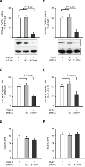 Figure 2: Reduction of cellular migration in SW620 and DLD-1 colorectal cancer cell lines after S100A4-shRNA transfection