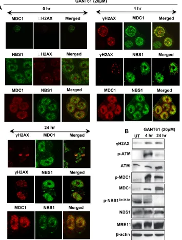 Figure 2: Expression of DNA damage-induced mediator proteins at 4 hr and 24 hr in HT29 cells following inhibition of GLI1/GLI2 by GANT61 (20 µM)