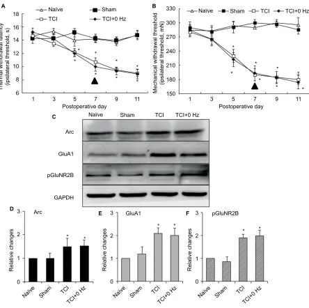 Figure S1 consistency testing between Tci group and Tci+0 hz group. Notes: (A) Thermal hyperalgesia; (B) mechanical allodynia (n of each group =8; data are presented as mean ± seM and analyzed with two-way anOVa); (C) typical Western blotting result of arc