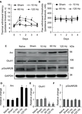 Figure 2 effect of different frequency Pns on pain thresholds as well as expression of arc, glua1, and pglunR2B in naïve rats