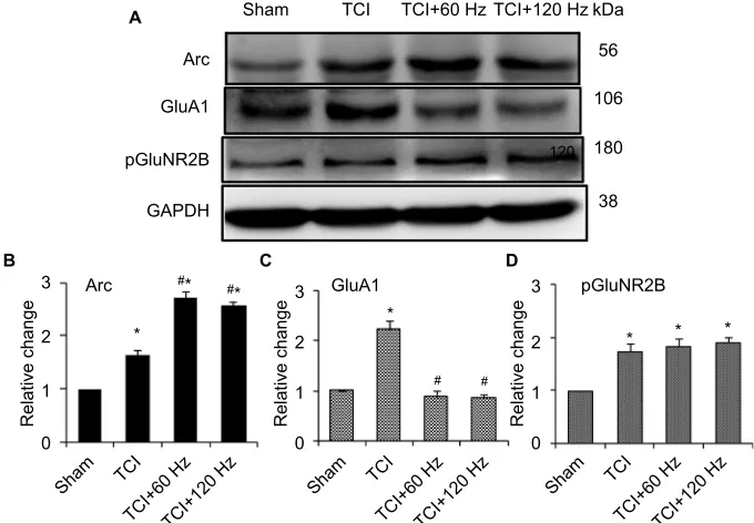 Figure 3 localization of increasing arc expression in spinal cord is detected with immunohistochemistry