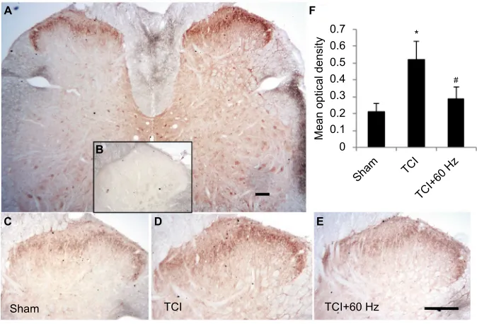 Figure 5 Increasing expression of GluA1 in superficial layers of the spinal cord in TCI model is downregulated by 60 Hz PNS
