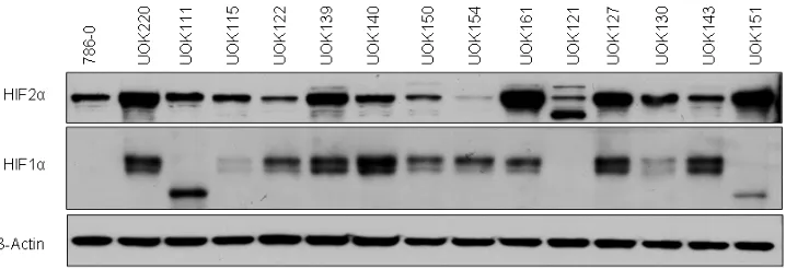 Figure 1: Characterization of the HIFα status of CCRCC cells. Protein expression of HIF1α and HIF2α was assessed by immunoblotting