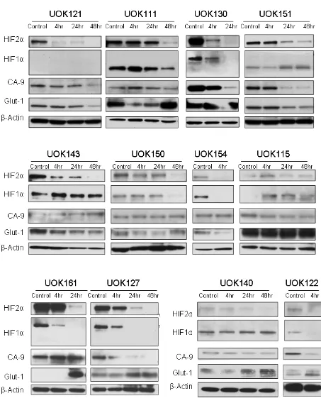 Figure 4: Tempol inhibits HIF2α in a panel of CCRCC cells. Twelve CCRCC cell lines were treated with 5mM Tempol for 4h, 24h or 48h before to be subjected to whole protein lysis, SDS-PAGE and immunoblotting for both HIFα isoforms and CA-9