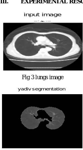 Fig 3 lungs image 