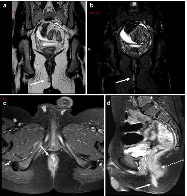 Fig. 13 Patient with abscessnonuniform fat saturation oncompared witharrowswith contrast-enhancement (show an abscess (with central cavity