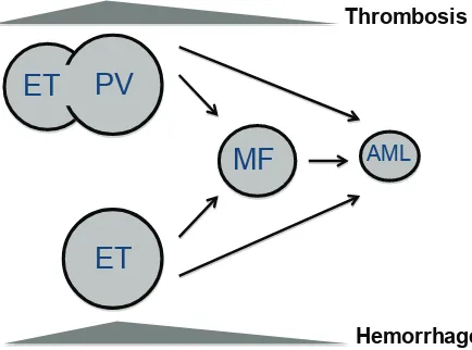figure 1: natural history of myeloproliferative neoplasms. patients are thrombosis, whereas hemorrhage is  above all observed in essential thrombocythemia (ET) patients