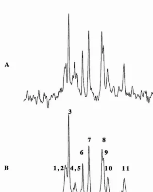 Figure 2.4 31p nmr spectra of human 1321 NI astrocytomas on microcanier beads recorded prior to (A), and subsequent to (B) a Li+-nmr experiment
