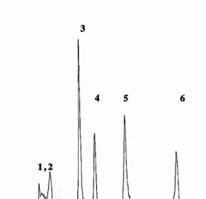Figure 2.5 /n v/vo^^P nmr spectrum ofthe head of an anaesthetised rat 