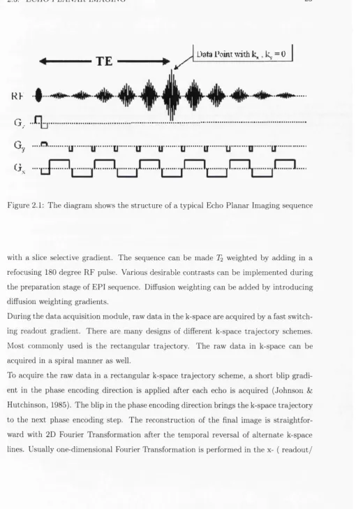 Figure 2.1: The diagram shows the structure of a typical Echo Planar Imaging sequence