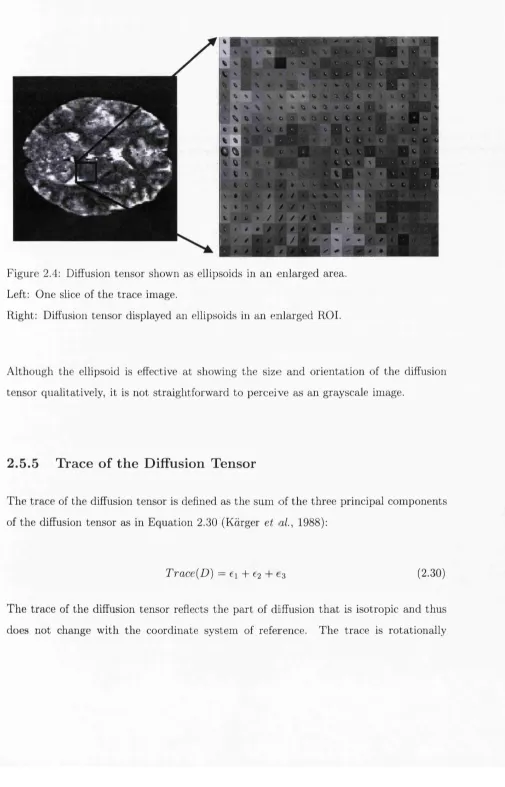 Figure 2.4: Diffusion tensor shown as ellipsoids in an enlarged area. 
