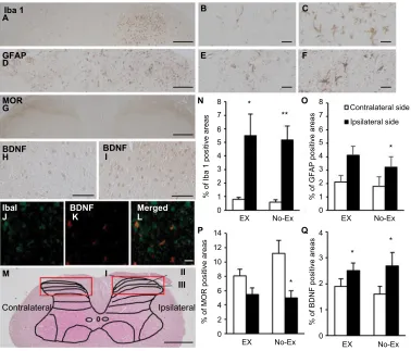 Figure 2 Photomicrographs of DaB staining of the immunoreactivity of iba1 (Notes: ipsilateral side (A–C, J), gFaP (D–F), MOR (G), and BDnF (H, I, K) in the no-ex group