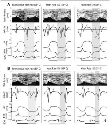 Figure 1 Recordings from spontaneous and atrially paced heart rates during normo (A) andearly (ethickening velocities synchronized with pressure measurements (LVP), dp/dt, and electrocardiogram(ECG) below