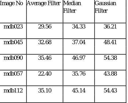 Table 1 Peak Signal to Noise Ratio Values in dB for Different Filtering Techniques 