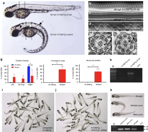 Figure 4 | Conserved function for PIH1D3 in vertebrate cilia motility and dynein arm assembly replicating the human disease