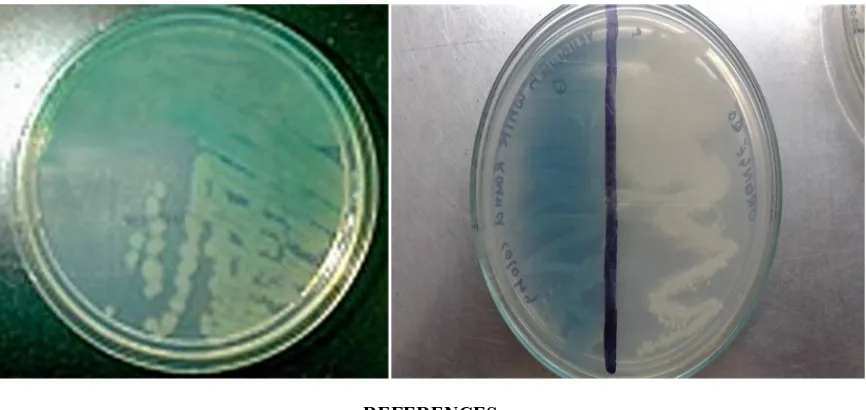 Figure 1 and 2 confirms the bacterial isolates as Bacillus sp. and Pseudomonas sp. 