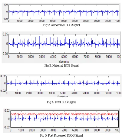 Fig 2. Abdominal ECG Signal 