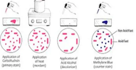 Fig 1: Image of manual testing of Z-N method 