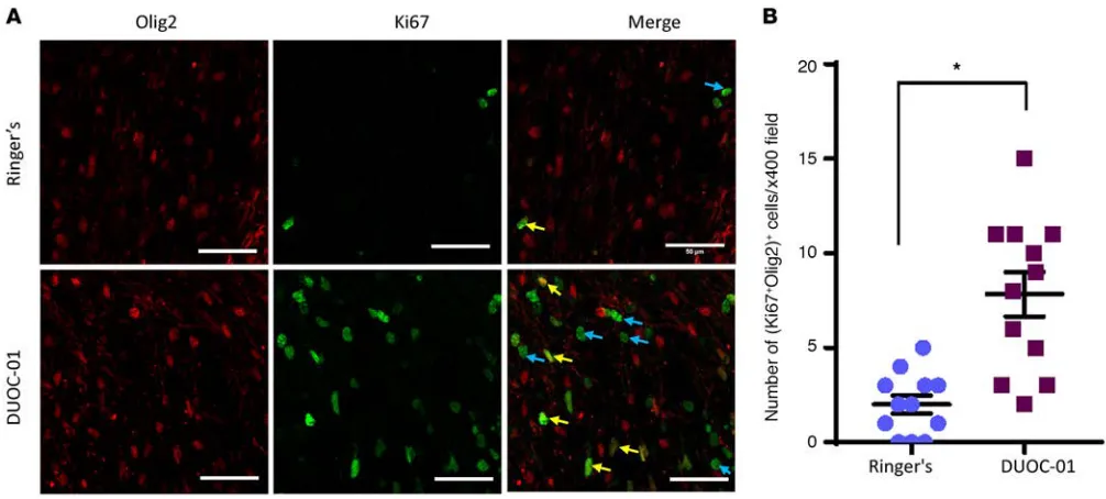 Figure 8. DUOC-01 treatment promotes oligodendrocyte proliferation. (A) Representative image of corpus callosum area of brains of cuprizone-fed mice treated with DUOC-01 cells (lower panels) or Ringer’s solution (upper panels) stained with antibodies again