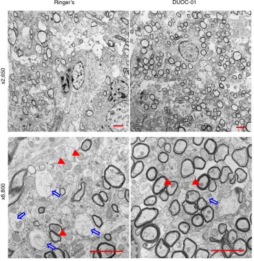 Figure 5. (upper panels) and week after injection of Ringer’s solution (left panels) or DUOC-01 cells (right panels)