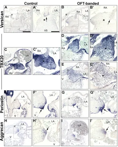 Fig. 7. Normal atrial septation with mild differential expression of an endocardial cushion marker in haemodynamically altered hearts at HH26