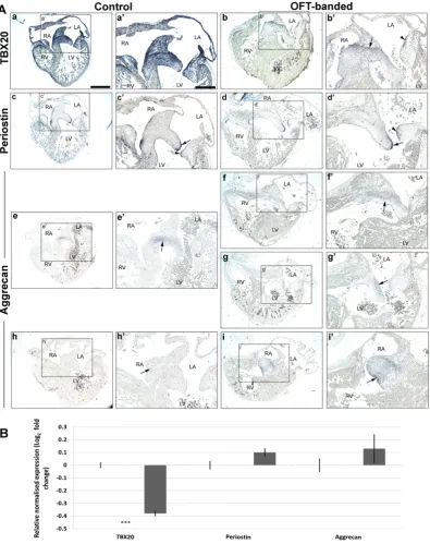 Fig. 2. Expression of early extracellular matrix markers characteristic of valve primordia differentially expressed at HH29 upon alteration of haemodynamics