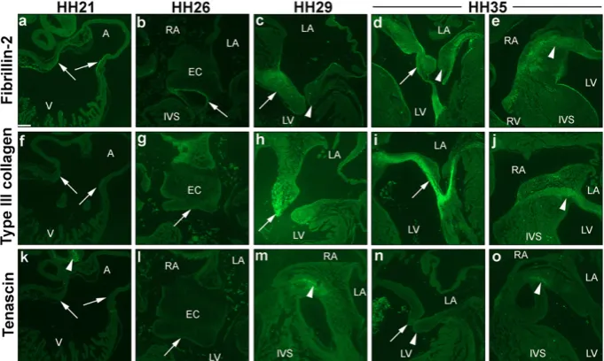 Fig. 5. Cardiac spatial-temporal expression proA, atria; IVS, interventricular septum; LA, left atrium; LV, left ventricle; RA, right atrium; RV, right ventricle; V, ventricle; n = 2 per stage