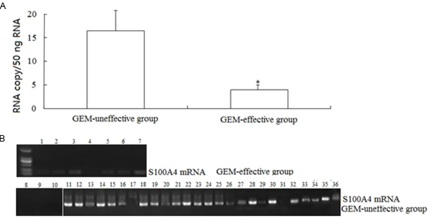 Figure 2. Levels of transcripts of S100A4 in tumor samples of GEM-non-effective group and GEM-effective group (expressed as transcript copy number per 50 ng of messenger RNA and standardized with β-actin)