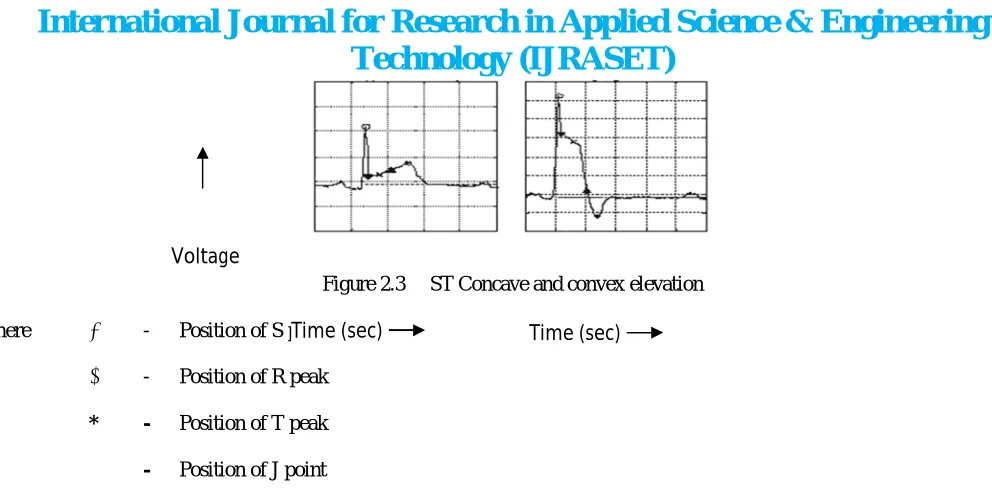 Figure 2.3     ST Concave and convex elevation 