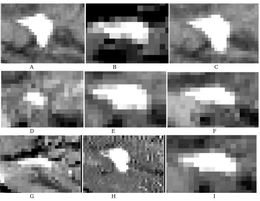 Fig 2 : Comparison of Results 