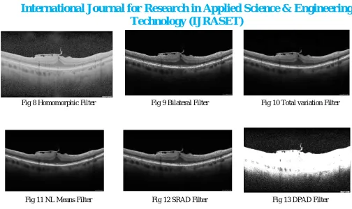 Fig 10 Total variation Filter 