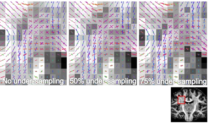 Figure 7: Comparison showing the stability of ﬁber orientation and volume fraction estimateswith acceleration (under-sampling)