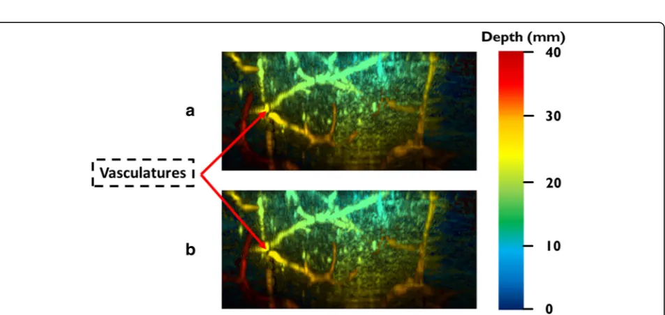 Fig. 4 a Comparison of reconstruction time between MCC, MCCC and MWGC and b a close look into reconstruction time difference between MCCand MCCC codes with different RF