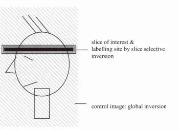 Figure 3-2 Schematic representation of basic setup FAIR, a pulsed labelling technique.
