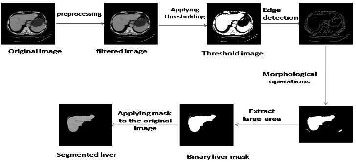 Figure 1: Flow diagram of Computerized System for Liver CT Segmentation 