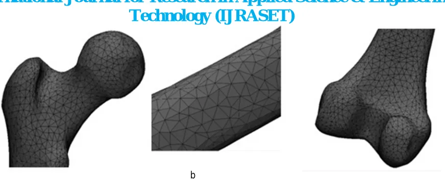 Figure 6 (a&b):  Surface Meshing of the femur model 