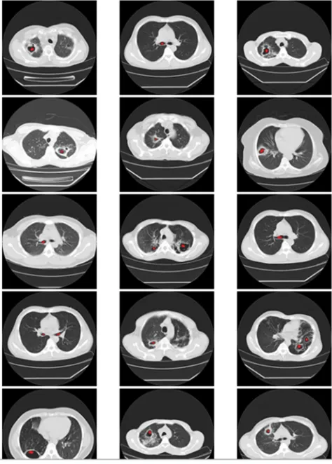 Fig. 3 Collection of the retrieval slices of proposed system 