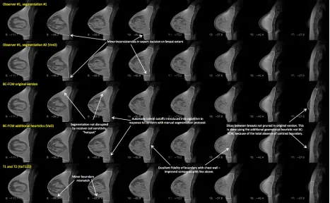 FIG. 5: : Example of a case where both of the algorithms examined in this work