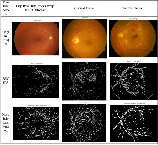 Table 1 Results obtained for images from High Resolution Fundus (HRF) database, bankers database and ‘diaretdb’ database 
