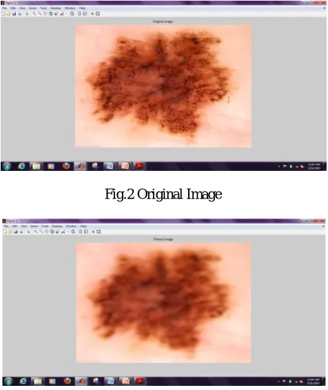 Fig.2 Original Image 