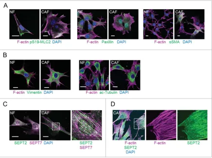 Figure 1. Cytoskeletal networks in normal mammaryimages of F-actin (magenta), pS19-MLC2 (green) and DAPI (blue)