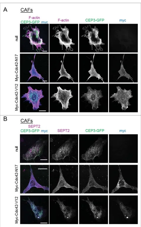 Figure 4. Modulating the activity of Cdc42 in CAFs affects Cdc42EP3 localization and septin and F-actin organization