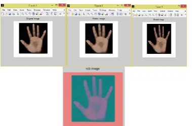 Figure 8: Segmented Image   