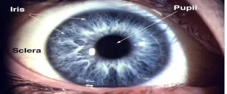 Fig 1: Example of an iris pattern