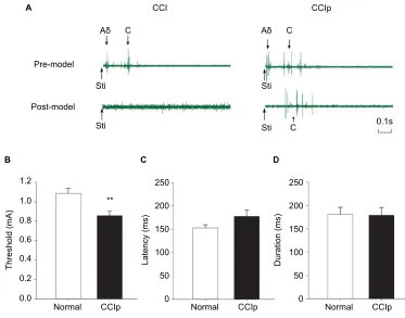 Figure 5 Threshold, latency, and duration of ANotes: (A)stimulation induced independent EMG responses with different latencies in CCI and CCIp rats