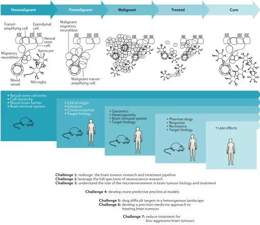 Fig. 1 | Challenges to curing primary brain tumours at different stages of tumour development