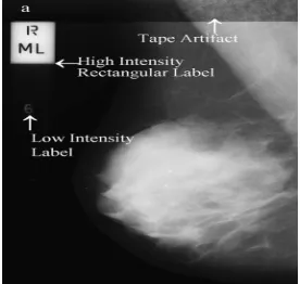 Figure 1: Types of noise observed in mammogram. 