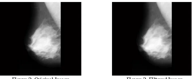 Figure 4: 8-neighborhood connectivity  Connectivity defines which pixels are connected to other pixels
